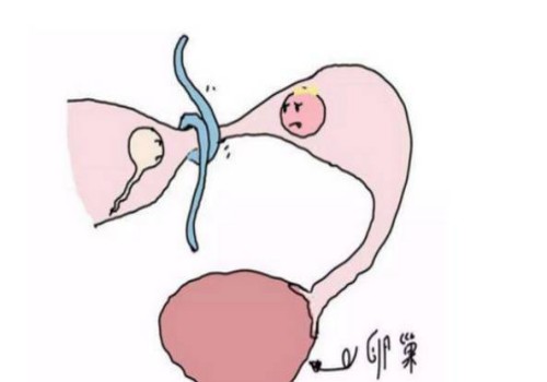 内膜10.1a型不算差，过来人表示很适合移植