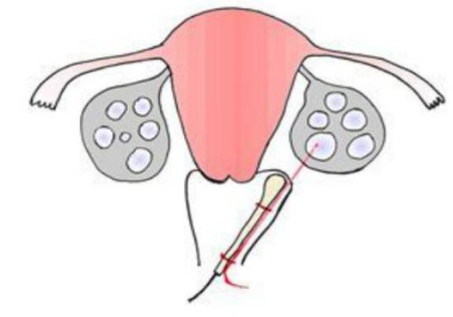 宝宝护臀霜有必要买吗？附婴儿使用护臀霜的利与弊