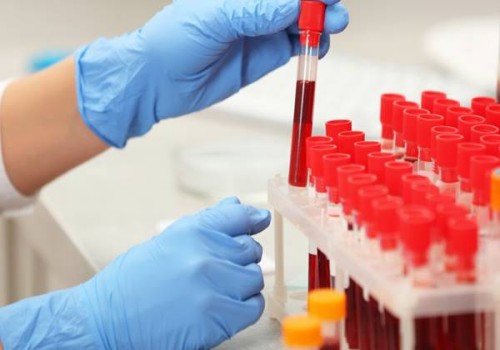 促排卵卵泡监测要检测的指标，这三项要合格